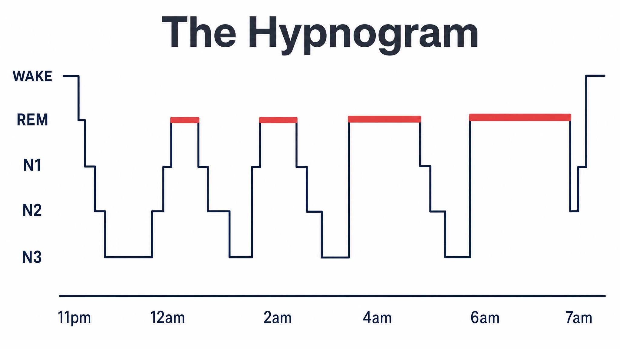 The hypnogram of one night