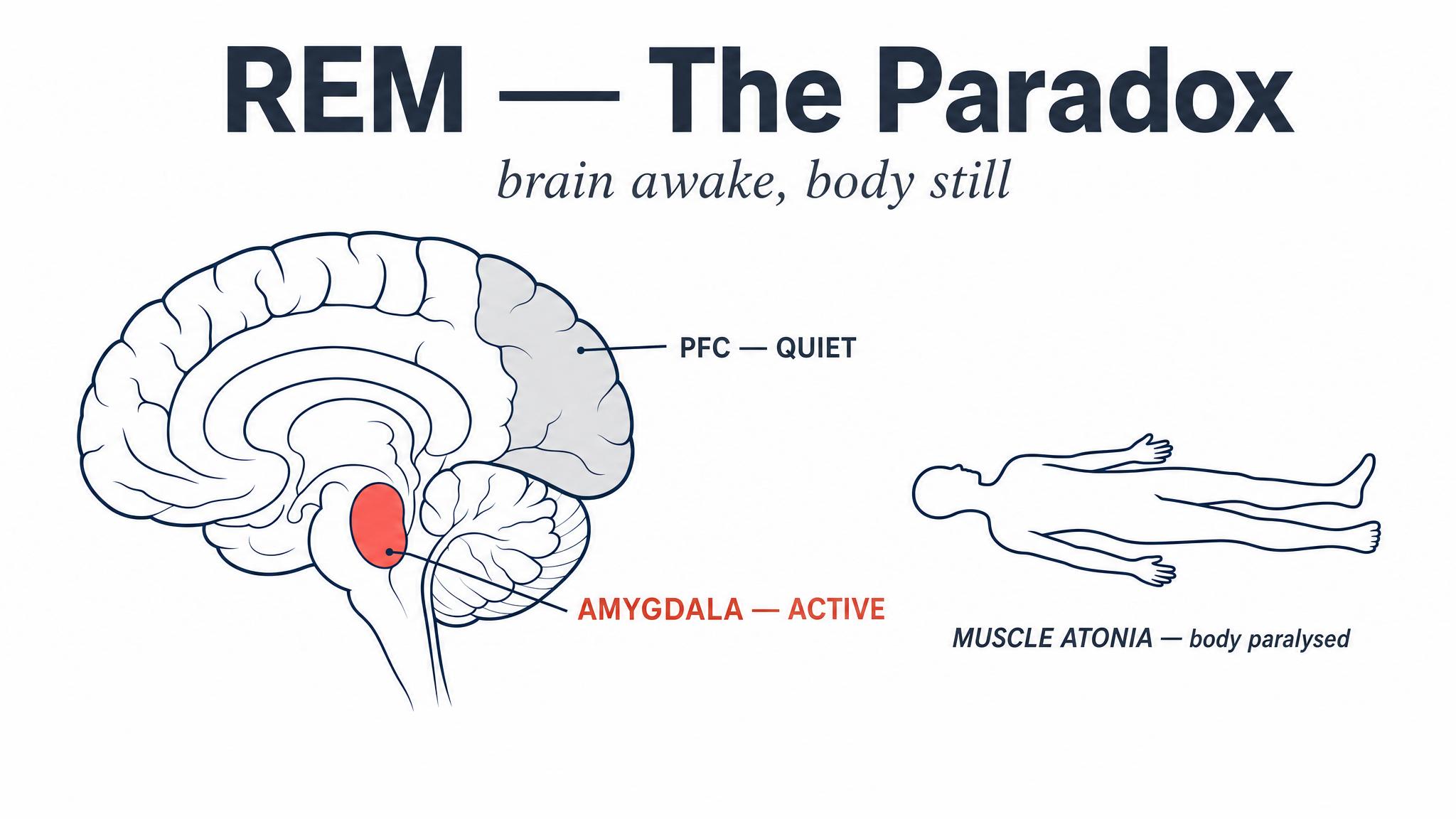 REM — the paradox
